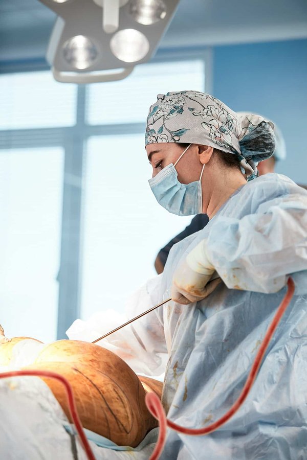 Liposuccion vaser : les principales étapes de l'opération