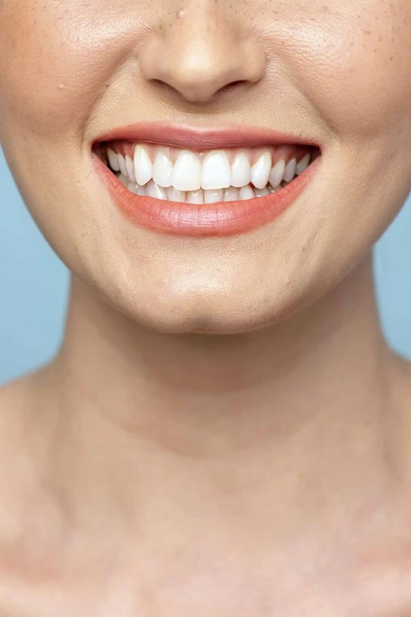 Comment un centre dentaire peut-il améliorer votre sourire ?